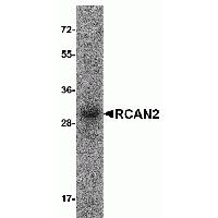 SDS-PAGE analysis of recombinant RCAN2 on Coomassie Blue-stained 12% SDS-PAGE gel.