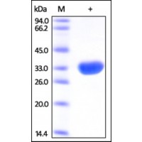 The purity of rh SBDS was determined by DTT-reduced (+) SDS-PAGE and staining overnight with Coomassie Blue.