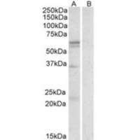 Western blot analysis of SLC7A5 in Human Spleen Lysate (35 μg protein in ripa buffer) with (b) and without (a) blocking with the immunizing peptide using SLC7A5 antibody (0.3 μg/mL).