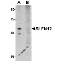 Western blot analysis of SLFN12 in SK-N-SH cell lysate with SLFN12 antibody at 1 μg/mL in (A) the absence and (B) the presence of blocking peptide.
