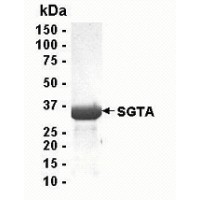 SDS PAGE: Analysis of SGTA Recombinant Protein. 4-20% SDS gradient gel. Coomassie blue staining.