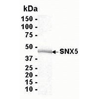 SDS PAGE: Analysis of SNX5 Recombinant Protein. 4-20% SDS gradient gel. Coomassie blue staining.