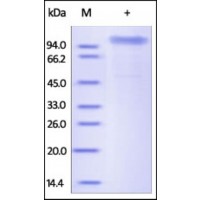 The purity of rh COMP was determined by DTT-reduced (+) SDS-PAGE and staining overnight with Coomassie Blue.