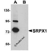 Western blot analysis of SRPX1 in SK-N-SH cell lysate with SRPX1 antibody at 0.25 μg/mL in (A) the absence and (B) the presence of blocking peptide.