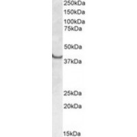 Western blot analysis of SSBP2 in Human Heart Lysate (35 μg protein in ripa buffer) using SSBP2 antibody (0.3 μg/mL).