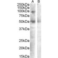 Western blot analysis of SULF2 in Human Ovary Lysate (35 μg protein in RIPA buffer) with (B) and without (A) blocking with the immunizing peptide using SULF2 antibody (0.3 μg/mL).
