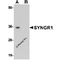 Western blot analysis of SYNGR1 in rat brain tissue lysate with SYNGR1 antibody at 1 μg/mL in (A) the absence and (B) the presence of blocking peptide.