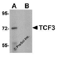 Western blot analysis of TCF3 in Human brain tissue lysate with TCF3 antibody at 1 μg/mL in (A) the absence and (B) presence of peptide blocking.