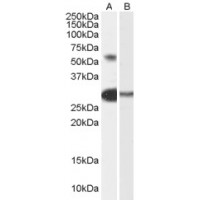 Western blot analysis of TCFL5 in Human Testis Lysate (35 μg protein in RIPA buffer) with (B) and without (A) blocking with the immunizing peptide using TCFL5 antibody (0.3 μg/mL).