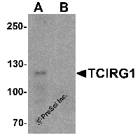 Western blot analysis of TCIRG1 in EL4 cell lysate with TCIRG1 antibody at 0.5 μg/ml in (A) the absence and (B) the presence of blocking peptide.