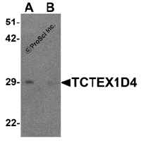 Western blot analysis of TCTEX1D4 in mouse liver tissue lysate with TCTEX1D4 antibody at 1 μg/mL in (A) the absence and (B) the presence of blocking peptide.