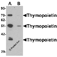 Western blot analysis of Thymopoietin in HeLa cell lysate with Thymopoietin antibody at 0.25 μg/mLl in (A) the absence and (B) the presence of blocking peptide.