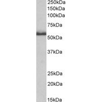 Western blot analysis of Tnfrsf1b in Rat Spinal Cord Lysate (35 μg protein in RIPA buffer) using Tnfrsf1b antibody (0.2 μg/mL).