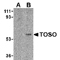 Western blot analysis of Toso in human lung tissue lysate with Toso antibody at 1 μg/mL in either the (A) presence, or (B) absence of blocking peptide (2273P).