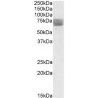 Western blot analysis of TPP1 in Human Placenta Lysate (35 μg protein in RIPA buffer) with (B) and without (A) blocking with the immunizing peptide using TPP1 antibody (0.3 μg/mL).