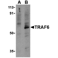 Western blot analysis of TRAF6 in PC-3 cell lysates with TRAF6 antibody at 1 μg/mL in the presence (A) or absence (B) of 1 μg blocking peptide (3129P).