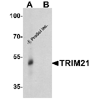 Western blot analysis of TRIM21 in human lung tissue lysate with TRIM21 antibody at 0.5 μg/ml in (A) the absence and (B) the presence of blocking peptide.