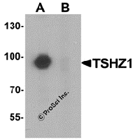 Western blot analysis of TSHZ1 in A-20 cell lysate with TSHZ1 antibody at 1 μg/mL in (A) the absence and (B) the presence of blocking peptide.