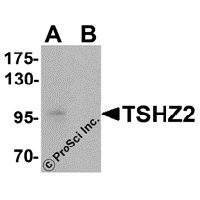 Western blot analysis of TSHZ2 in A-20 cell lysate with TSHZ2 antibody at 1 μg/mL in (A) the absence and (B) the presence of blocking peptide.