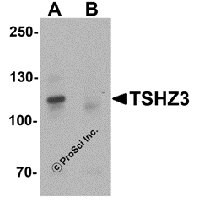 Western blot analysis of TSHZ3 in mouse brain tissue lysate with TSHZ3 antibody at 1 μg/mL in (A) the absence and (B) the presence of blocking peptide.