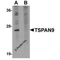 Western blot analysis of TSPAN9 in EL4 cell lysate with TSPAN9 antibody at 1 μg/mL in (A) the absence and (B) the presence of blocking peptide.