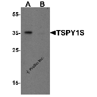 Western blot analysis of TSPY1S in A20 cell lysate with TSPY1S antibody at 1 μg/mL in (A) the absence and (B) the presence of blocking peptide.