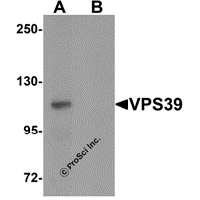 Western blot analysis of VPS39 in rat liver tissue lysate with VPS39 antibody at 0.5 μg/mL in (A) the absence and (B) the presence of blocking peptide.