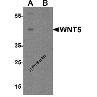 Western blot analysis of WNT5 in Jurkat cell lysate with WNT5 antibody at 1 μg/ml in (A) the absence and (B) the presence of blocking peptide.