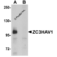 Western blot analysis of ZC3HAV1 in HeLa cell lysate with ZC3HAV1 antibody at 1μg/mL in (A) the absence and (B) the presence of blocking peptide.