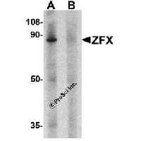 Western blot analysis of ZFX human small intestine tissue lysate with ZFX antibody at 1 μg/ml in (A) the absence and (B) the presence of blocking peptide.