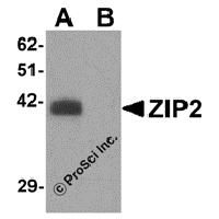 Western blot analysis of ZIP2 in rat brain tissue lysate with ZIP2 antibody at 1 μg/mL in (A) the absence and (B) the presence of blocking peptide.
