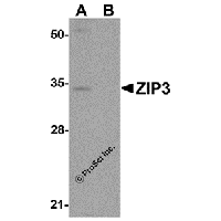 Western blot analysis of ZIP3 in mouse lung tissue lysate with ZIP3 antibody at 1 μg/mL in (A) the absence and (B) the presence of blocking peptide.