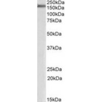 Western blot analysis of ZO-1 in Human Cerebral Cortex Lysate (35 μg protein in ripa buffer) using ZO-1 antibody (0.3 μg/mL).