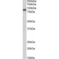 Western blot analysis of ZYX in Peripheral Blood Mononucleocyte Lysate (35 μg protein in ripa buffer) using ZYX antibody (0.1 μg/mL).
