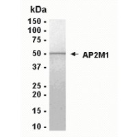 SDS PAGE: Analysis of AP2M1 Recombinant Protein. 4-20% SDS gradient gel. Coomassie blue staining.