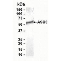 SDS PAGE: Analysis of ASB3 Recombinant Protein. 4-20% SDS gradient gel. Coomassie blue staining.