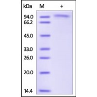 The purity of rh BCHE / Butyrylcholinesterase was determined by DTT-reduced (+) SDS-PAGE and staining overnight with Coomassie Blue.