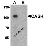 Western blot analysis of CASK in mouse brain tissue lysate with CASK antibody at 1 μg/ml in (A) the absence and (B) the presence of blocking peptide.