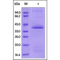 The purity of rh S100A12 /EN-RAGE, Heavy Labeled was determined by DTT-reduced (+) SDS-PAGE and staining overnight with Coomassie Blue.