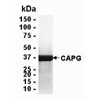 SDS PAGE: Analysis of CAPG Recombinant Protein. 4-20% SDS gradient gel. Coomassie blue staining.
