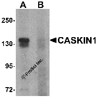 Western blot analysis of CASKIN1 in HeLa cell lysate with CASKIN1 antibody at 1 μg/ml in (A) the absence and (B) the presence of blocking peptide.
