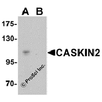 Western blot analysis of CASKIN2 in Hela cell lysate with CASKIN2 antibody at 1 μg/mL in (A) the absence and (B) the presence of blocking peptide.