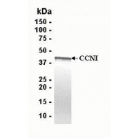 SDS PAGE: Analysis of CCNI Recombinant Protein. 4-20% SDS gradient gel. Coomassie blue staining.