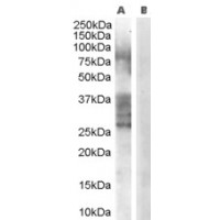 Western blot analysis of ADAM33 in Human Prostate Lysate (35 μg protein in RIPA buffer) with (B) and without (A) blocking with the immunizing peptide using ADAM33 antibody (0.3 μg/mL).