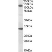 Western blot analysis of CCAR1 in Rat Skeletal Muscle Lysate (35 μg protein in ripa buffer) using CCAR1 antibody (1 μg/mL).