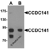 Western blot analysis of CCDC141 in SK-N-SH cell tissue lysate with CCDC141 antibody at 1 μg/mL in (A) the absence and (B) the presence of blocking peptide.