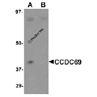 Western blot analysis of CCDC69 in mouse lung tissue lysate with CCDC69 antibody at 1 μg/mL in (A) the absence and (B) the presence of blocking peptide.