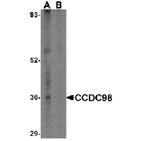 Western blot analysis of CCDC98 in human breast tissue lysate in (A) the absence and (B) presence of blocking peptide with CCDC98 antibody at 1 μg/mL.