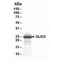 SDS PAGE: Analysis of CLIC3 Recombinant Protein. 4-20% SDS gradient gel. Coomassie blue staining.