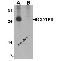 Western blot analysis of CD160 in K562 cell lysate with CD160 antibody at 1 μg/ml in (A) the absence and (B) the presence of blocking peptide.